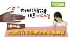 樓中亮：大姆指有青筋要注意心腦血管