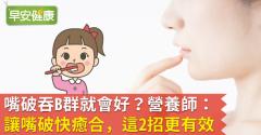 嘴破吞B群就會好？營養師：讓嘴破快癒合，這2招更有效
