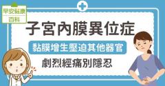 子宮內膜異位症：黏膜增生壓迫其他器官！劇烈經痛別隱忍