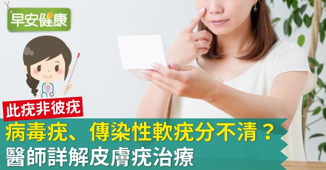 病毒疣擦藥膏有用嗎？醫師詳解皮膚疣治療