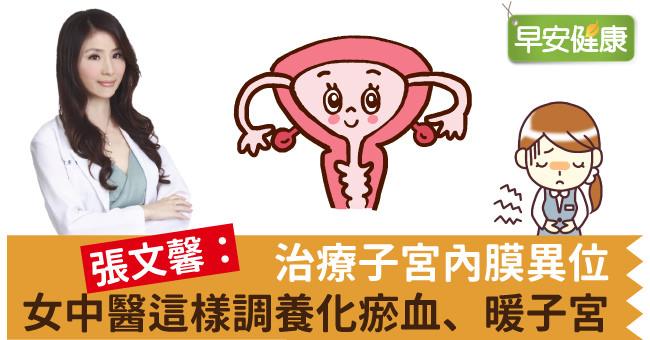 治療子宮內膜異位，女中醫這樣調養化瘀血、暖子宮