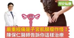 子宮肌腺瘤是經痛元兇！如何治療子宮肌腺症？