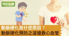 動脈硬化是什麼原因？動脈硬化預防之道搶救心血管