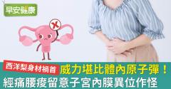 威力堪比體內原子彈！經痛腰痠留意子宮內膜異位作怪