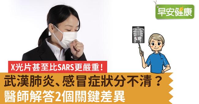 新冠肺炎、感冒症狀分不清？醫師解答2個關鍵差異