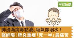 肺浸滿病毒黏液、吸氣像溺水！醫師曝：肺炎重症「死一半」最痛苦
