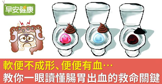 軟便不成形、便便有血…教你一眼讀懂腸胃出血的救命關鍵