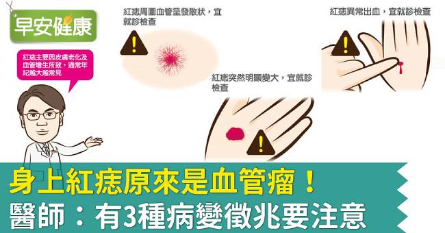 身上紅痣原來是血管瘤！醫師：有3種病變徵兆要注意