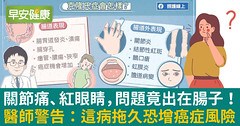 關節痛、紅眼睛，問題竟出在腸子！醫師警告：這病拖久恐增癌症風險