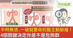平時無感、一破就要命的腹主動脈瘤！4個關鍵決定你是不是危險群