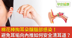 棉花棒掏耳朵釀腦部感染！避免耳垢向內推如何安全清耳道？