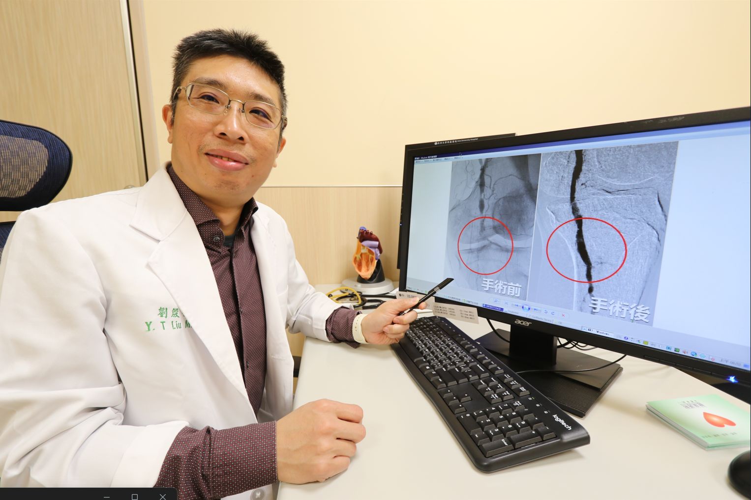 醫師透過氣球擴張術打通阻塞血管後,大幅改善下肢冰冷情形。