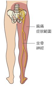 梨狀肌
