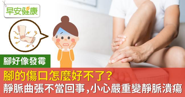 腳的傷口怎麼好不了？靜脈曲張不當回事，小心嚴重變靜脈潰瘍