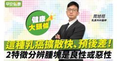 這種乳癌擴散快、預後差！爭取90％存活率關鍵是這招