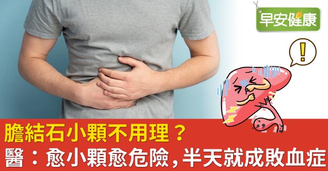 膽結石小顆不用理？醫：愈小顆愈危險，半天就成敗血症