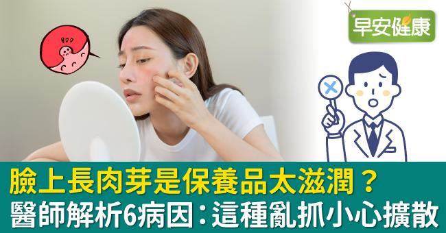 臉上長肉芽是保養品太滋潤？醫師解析6病因：這種亂抓小心擴散！