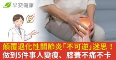 顛覆退化性關節炎「不可逆」迷思！做到5件事人變瘦、膝蓋不痛不卡